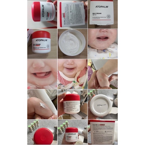 Kem Atopalm dưỡng chàm da,  Atopalm cho mẹ và bé đủ size 65ml, 50ml, 8ml - SHOP MẸ MIN