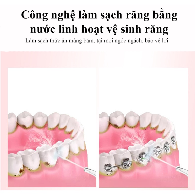 Tăm Nước Tích Hợp Pin Tuổi Thọ 90 Ngày Có 3 Chế Độ Chăm Sóc Răng Giúp Giảm 98% Mảng Bám Thức Ăn Bảo Vệ Lợi