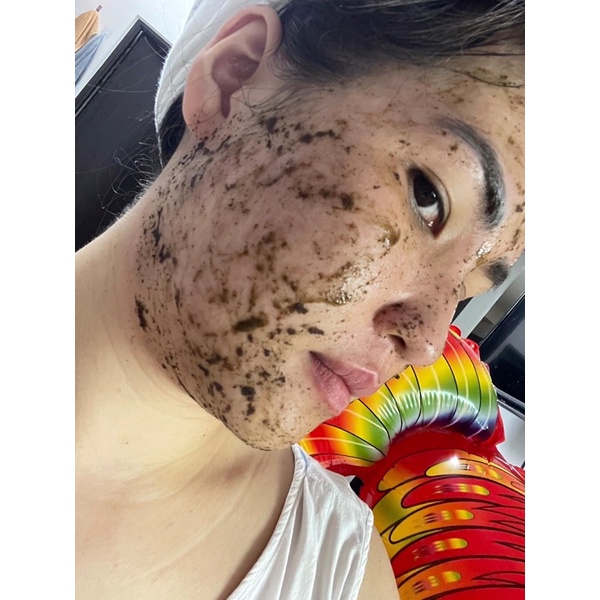 Sỉ 5 chai peel mặt vi tảo