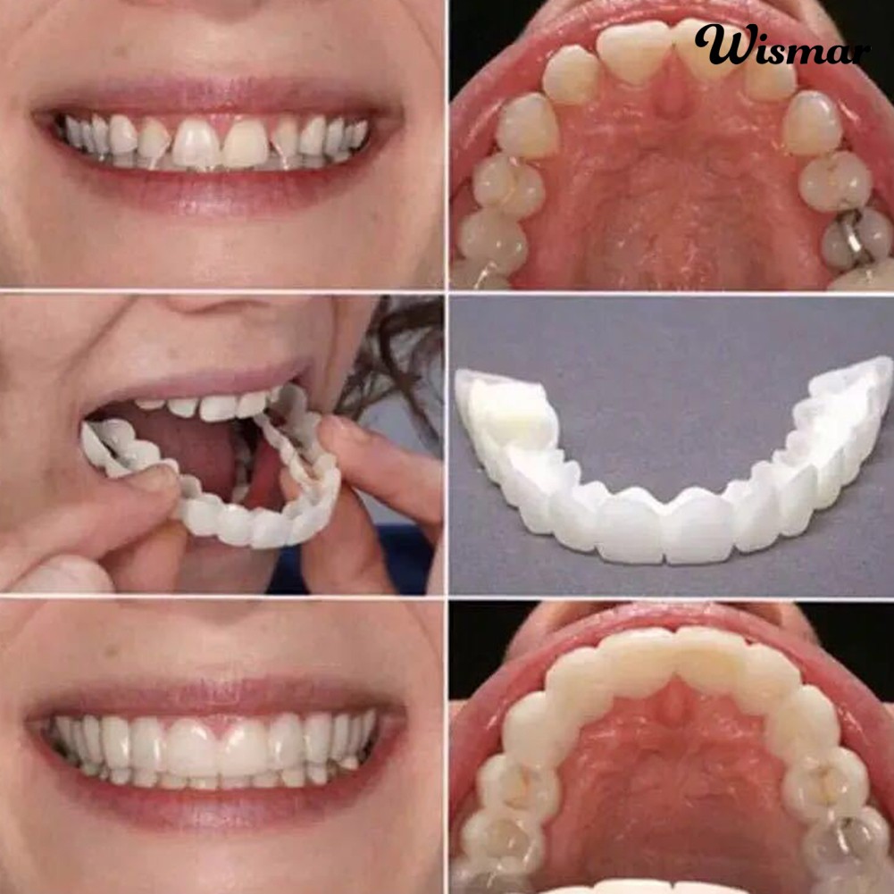 Bộ 2 hàm răng giả trên và dưới tiện lợi