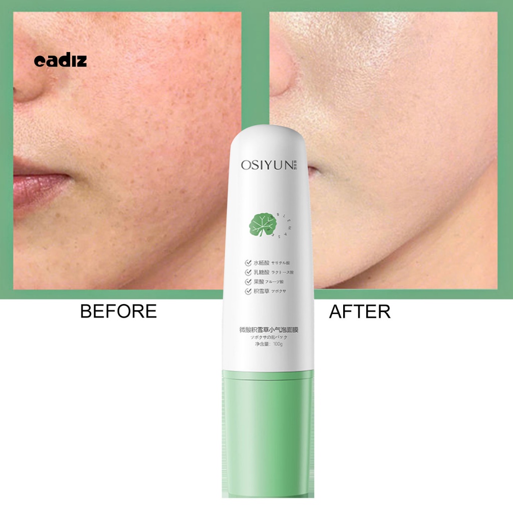 Sữa Rửa Mặt Tạo Bọt Loại Bỏ Mụn Đầu Đen Hiệu Quả Cho Nam Và Nữ