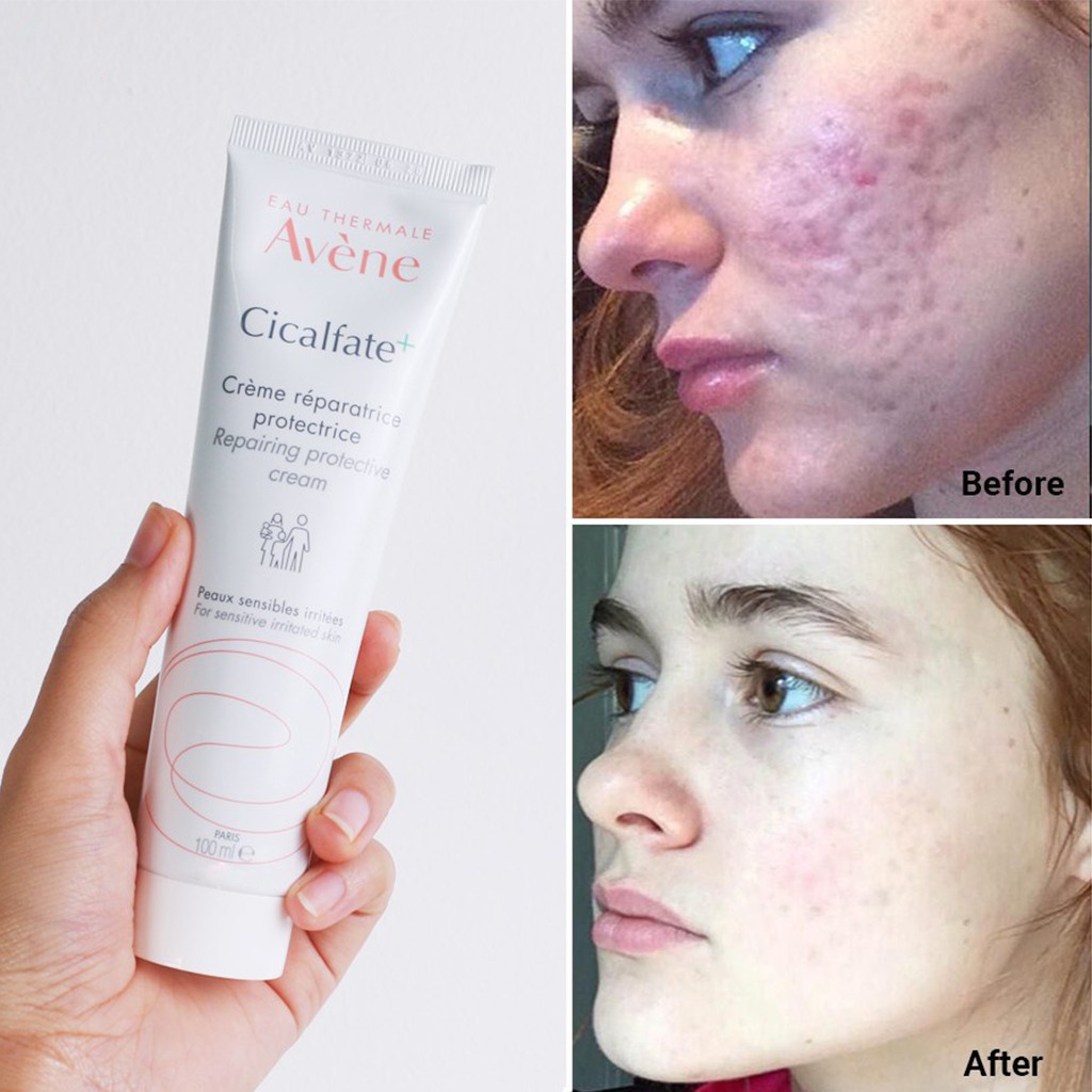 Kem Dưỡng Avene Cicalfate Repair Cream - Kem Giảm Thâm Phục Hồi Da 40ml - 100ml - Balan Shop