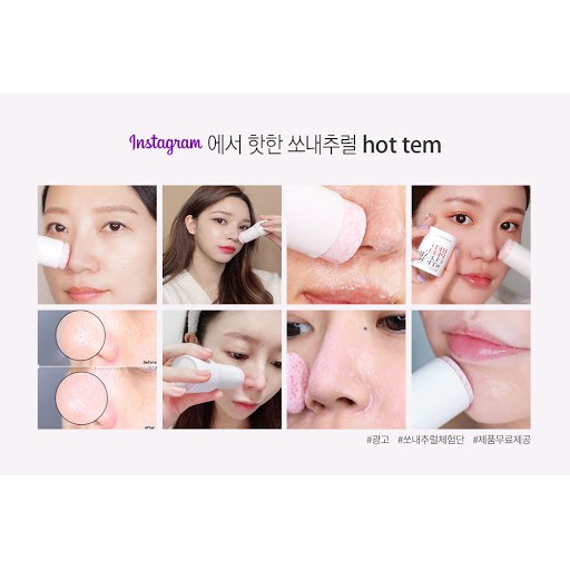 Thanh lăn mụn So’natural Red Peel Clear Stick | BigBuy360 - bigbuy360.vn