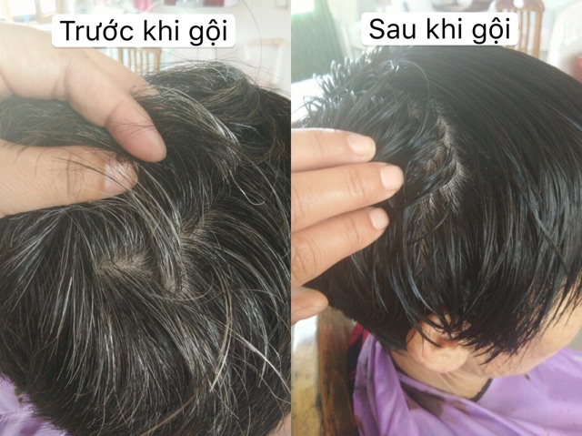 Gội nhuộm đen tóc MEIDU | BigBuy360 - bigbuy360.vn