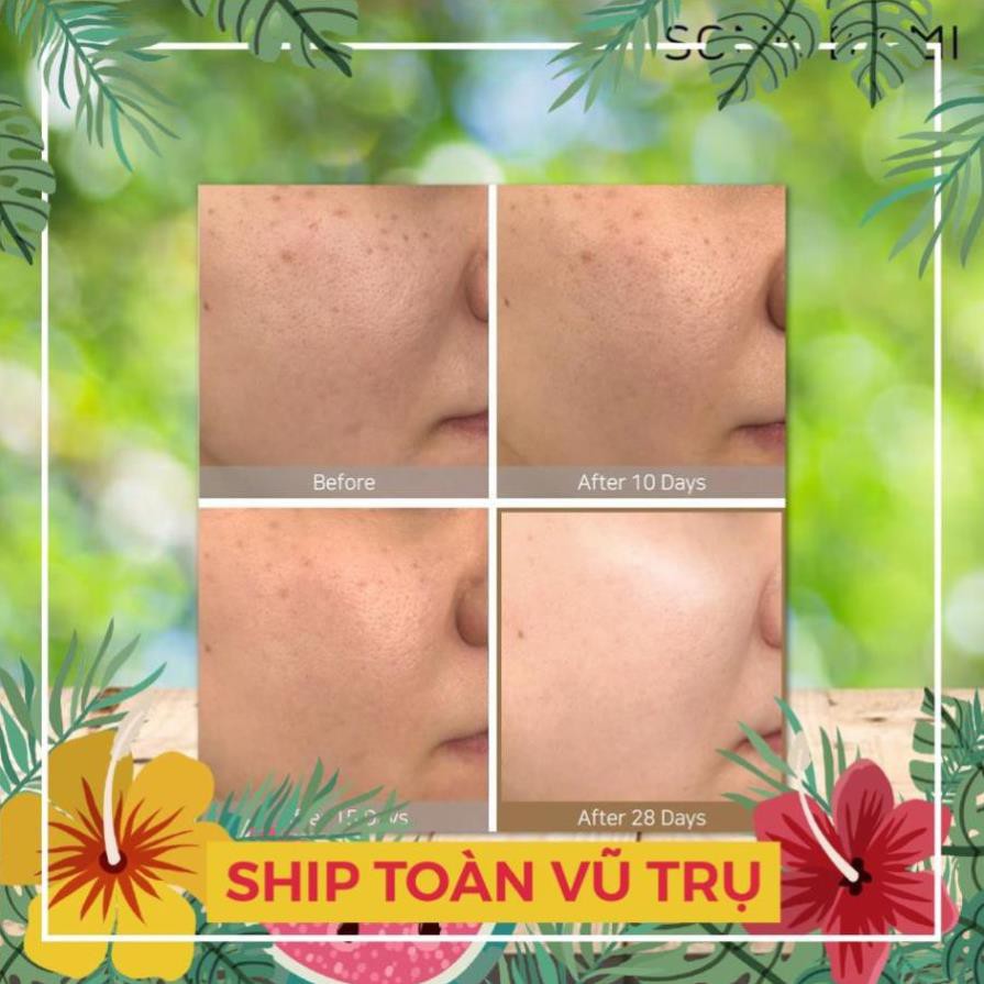 [FAKE TẶNG LUÔN] Nước Hoa Hồng Dưỡng Trắng, Chống Lão Hóa Some By Mi Galactomyces Pure Vitamin C Glow Toner 200ml