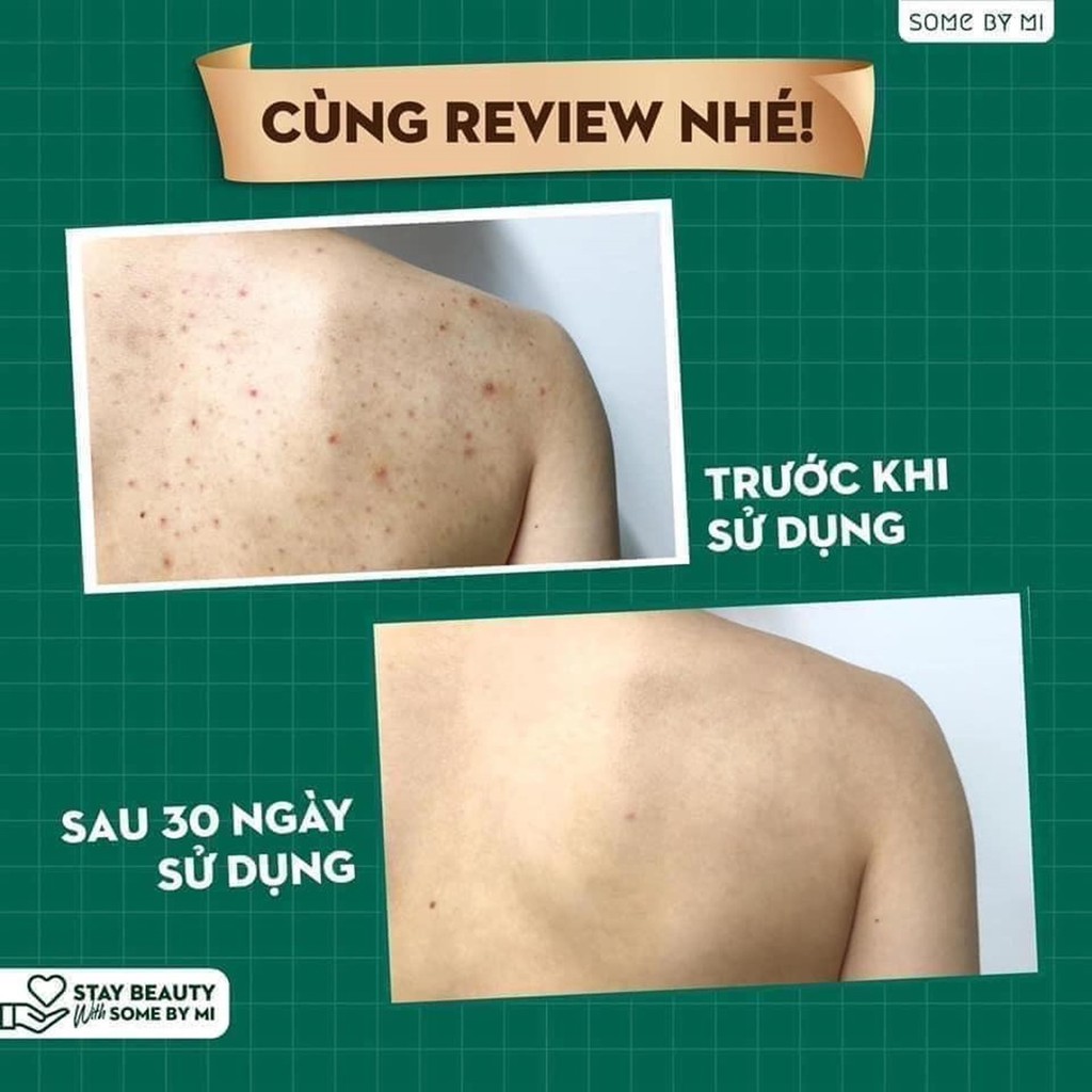 Sữa tắm mụn lưng, body Some by mi AHA.BHA.PHA 30 Days Miracle clear body cleanser 400g