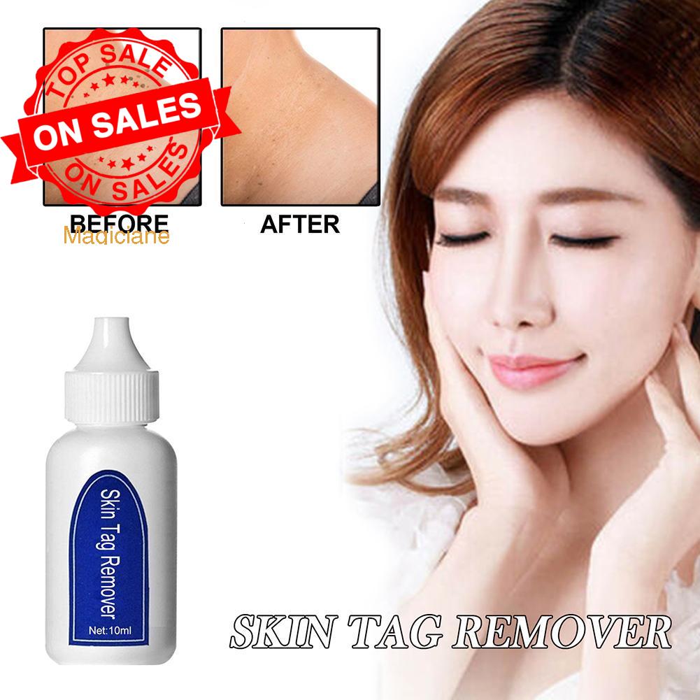 (Hàng Mới Về) Dung Dịch Trị Mụn Cóc 6ml Agai E6M6