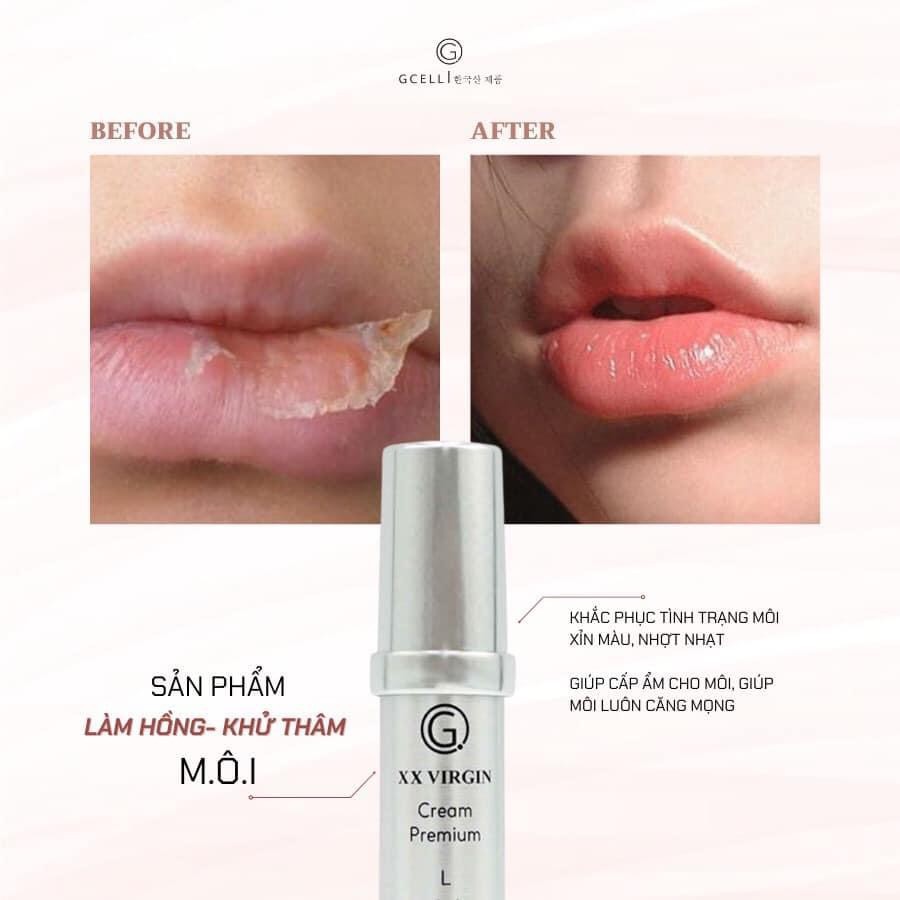 Kem làm HỒNG môi - XÓA thâm môi GCell XXVirgin Cream Premium L 5ml - Hàn Quốc