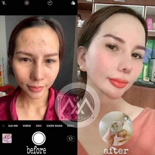 CAO MỤN SÂM ĐỎ 36 VỊ