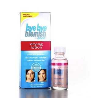 Lotion giảm mụn Bye bye blemish (Bill Mỹ)