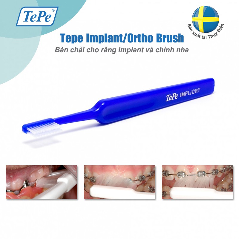 Bàn chải đánh răng chuyên biệt cho người niềng răng, chỉnh nha Tepe Implant Orthodontic