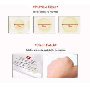 Miếng dán Mụn Ciracle Red Spot Acne Pimple Path 24 Miếng