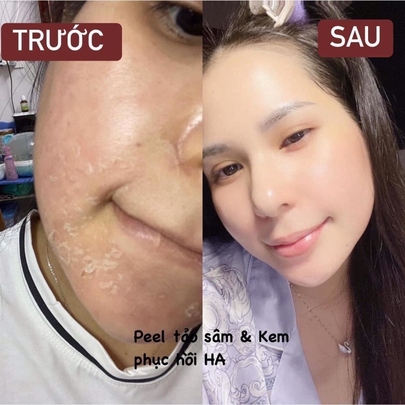 Feel Thay Da Mới Tảo Sâm MEEA - Tái Tạo Không Sưng Đỏ Da.