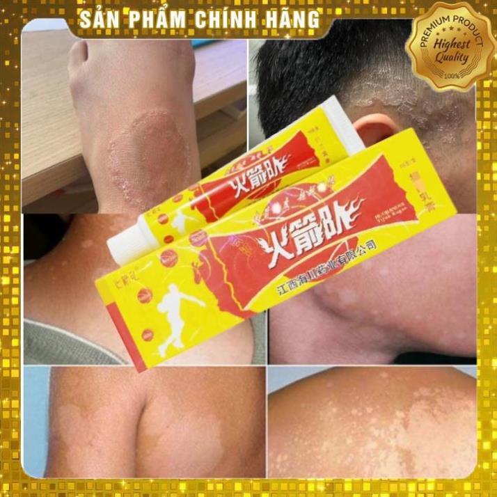 Kem bôi da nấm, ngứa, vảy nến, nứt nẻ, côn trùng muỗi đốt,... - Hàng có sẵn