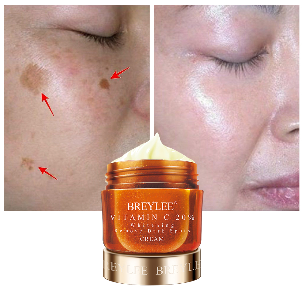 Kem dưỡng trắng da BREYLEE Vitamin C giúp làm mờ quầng thâm và nếp nhăn 40g