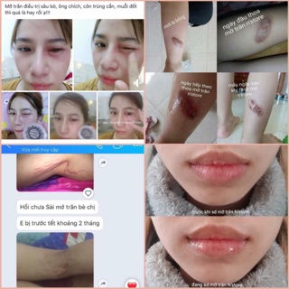 Mỡ trăn nguyên chất 100%