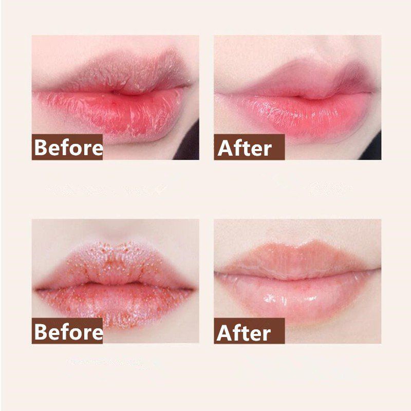 Tẩy tế bào chết của môi