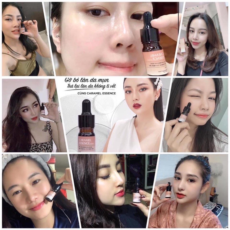 Serum Caramel Essence Ngừa Mụn Xoá Thâm 5ml | BigBuy360 - bigbuy360.vn