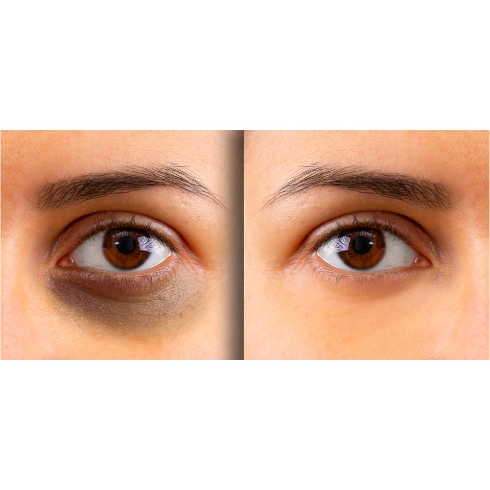 Mặt nạ mắt BIOAQUA giảm quầng thâm bọng mắt mask nội địa Trung | BigBuy360 - bigbuy360.vn