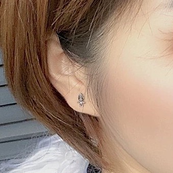 Khuyên hình thép y tế