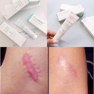 Kem mờ sẹo thâm Avène Cicalfate