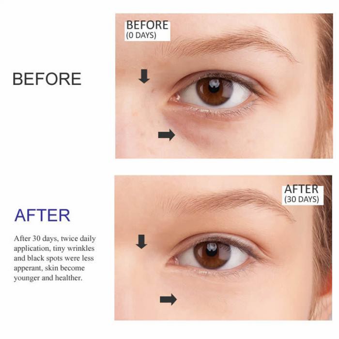 Serum collagen peptide argireline tổng hợp 6 axit amin xóa mờ nếp nhăn chống lão hóa dưỡng ẩm làm sáng da 5ml | BigBuy360 - bigbuy360.vn