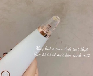 Combo 4 món skincare