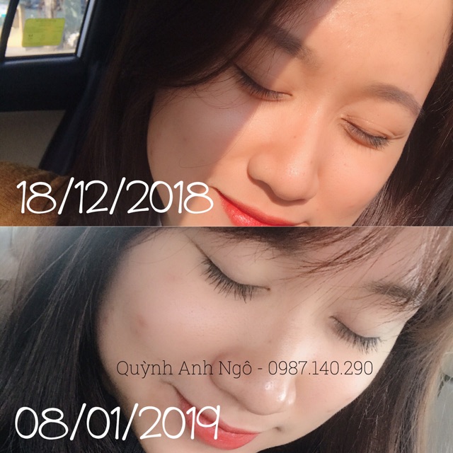 Mascara dưỡng mi KIKO 30 days (ngày + đêm) ảnh thật ở cuối