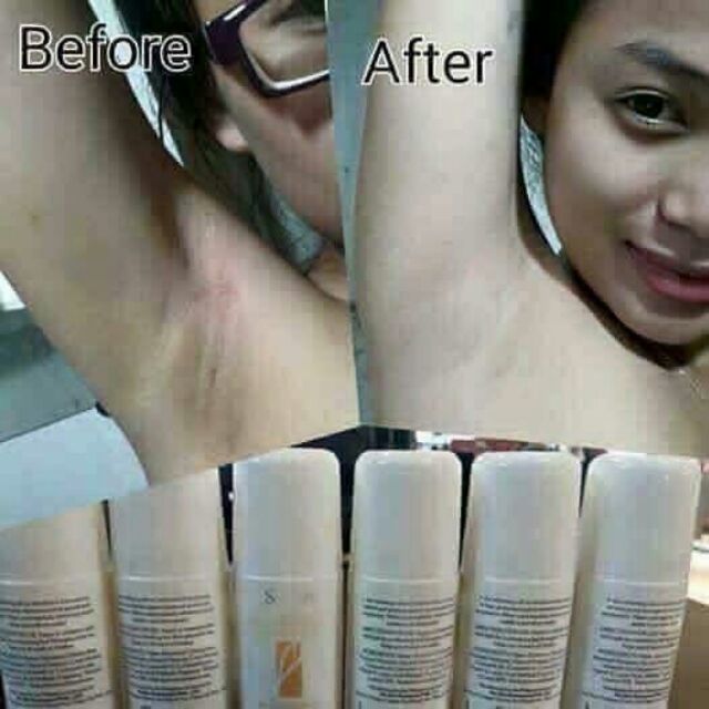 Lăn Nách SCION | BigBuy360 - bigbuy360.vn