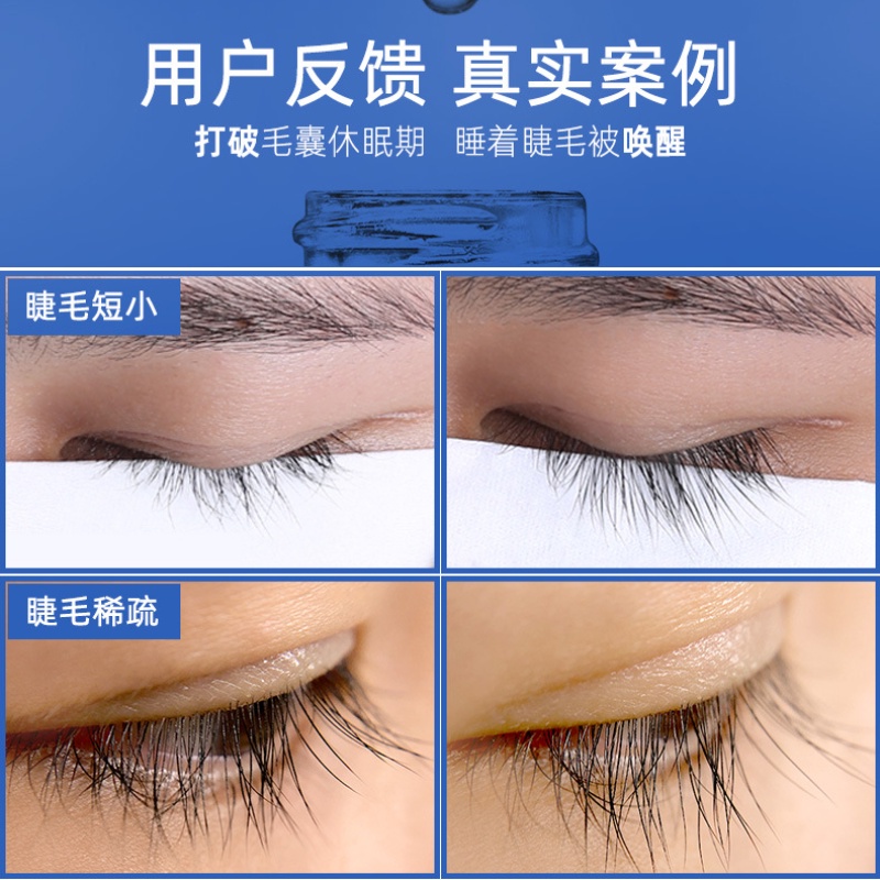 [Hàng mới về] Dung Dịch Kích Thích Mọc Lông Mi Dài Và Dày Tự Nhiên Màu Trong Suốt | BigBuy360 - bigbuy360.vn