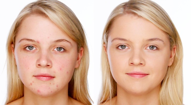 CHE KHUYẾT ĐIỂM 2 ĐẦU AGC | BigBuy360 - bigbuy360.vn