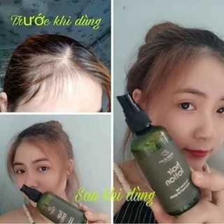 Tinh dầu bưởi VIJULLY hair lotion