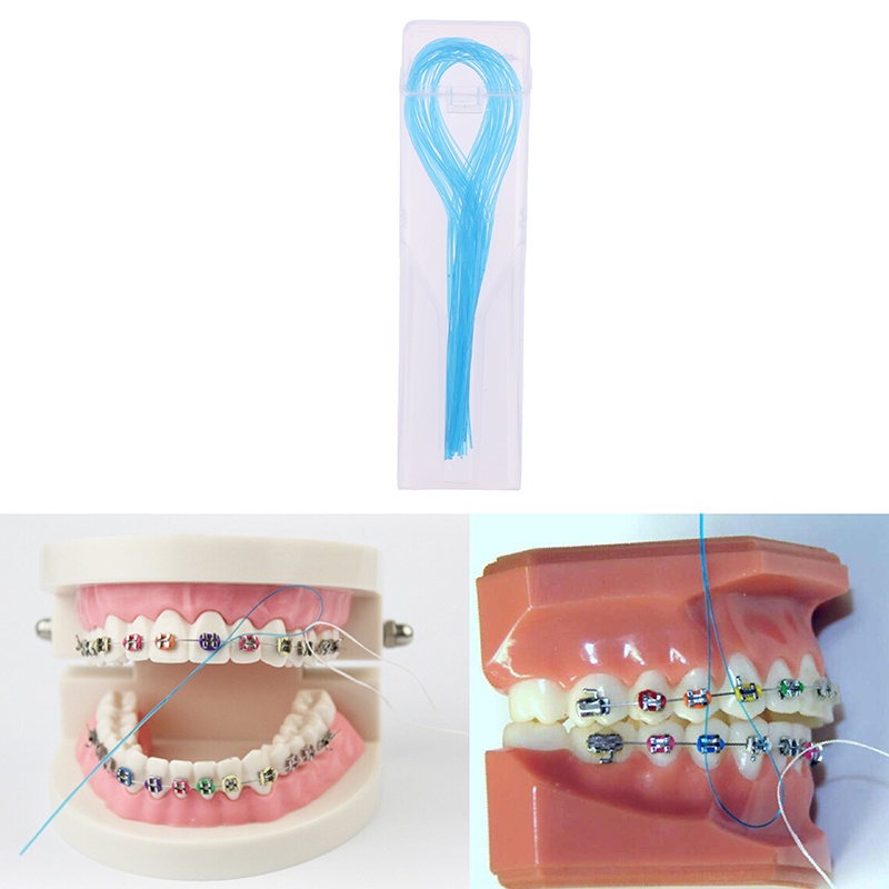 Set 35 Giá Đỡ Chỉ Nha Khoa Chỉnh Nha Chuyên Dụng