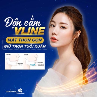 Dịch vụ độn cằm tại Gangwhoo