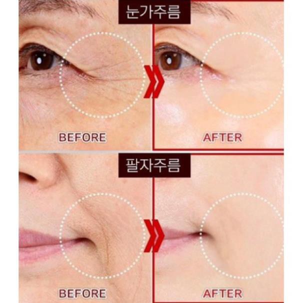 Kem trẻ hoá vùng mắt hoàn lưu cao Whoo Hwanyu Eye Cream 4ml date 2024