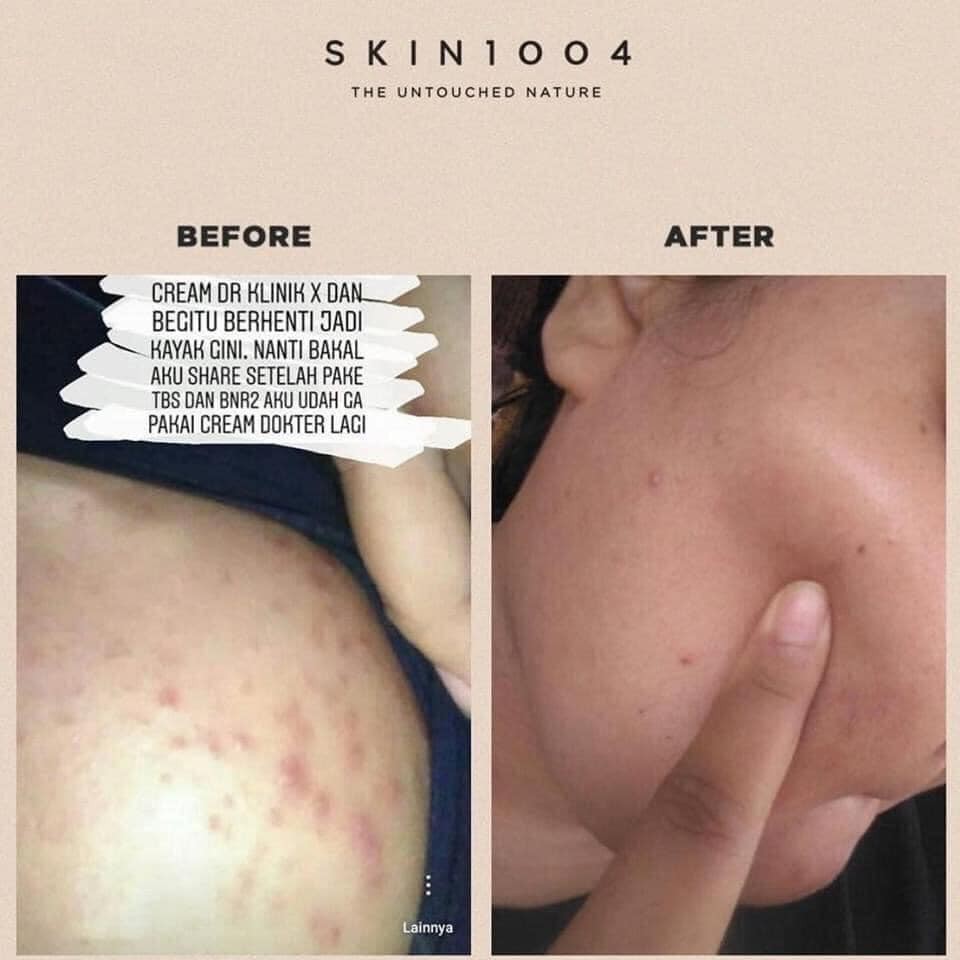 Kem Dưỡng Trắng Da, Giảm Mụn Chiết Xuất Rau Má Skin1004 Madagascar Centella Soothing Cream 75ml