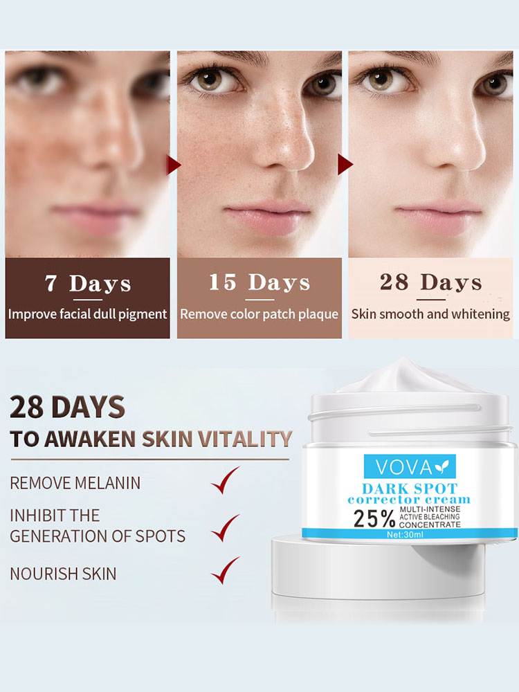 VOVA Effective Whitening Freckle Cream Remove Melasma Acne Spot Pigment Melanin Dark Spots Pigmentation Moisturizing Gel Skin Care -beauty