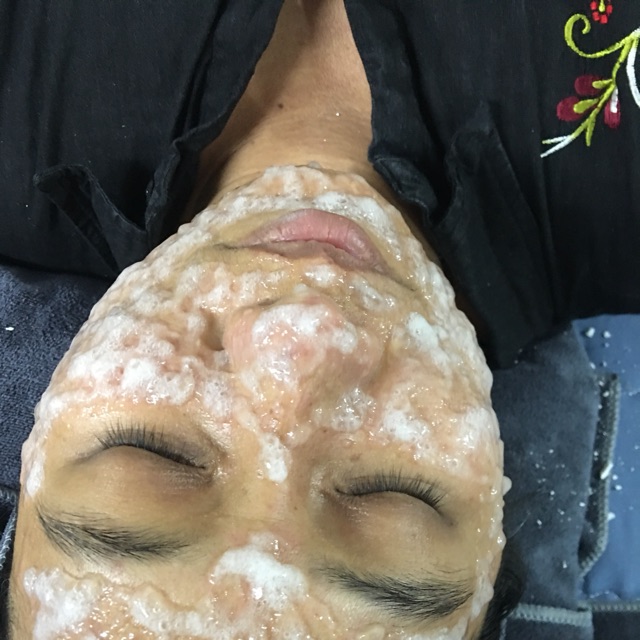 - Mặt hoa da phấn - Combo hấp trắng và hồi phục da tại Tam's beauty home spa