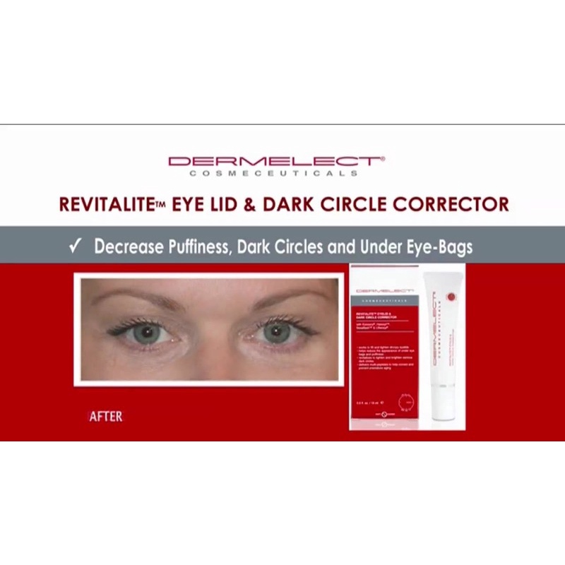 Kem Mắt REVITALITE Eyelid &amp; Dark Circle Corrector 3-in-1 (Bill Mỹ)