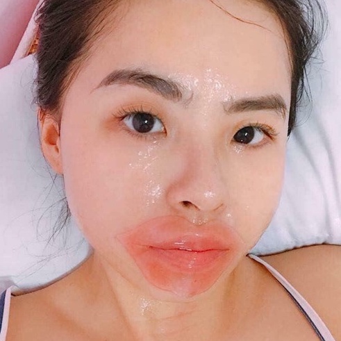 Mặt nạ môi Bioaqua nội địa Trung - Mask môi dưỡng môi hồng tự nhiên, dưỡng ẩm cực tốt