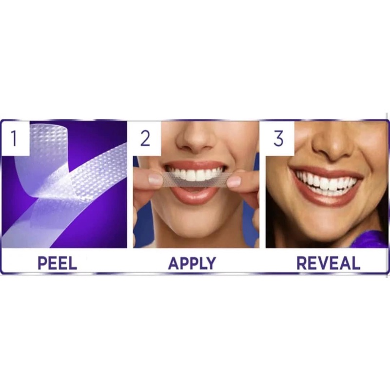 Miếng dán trắng răng