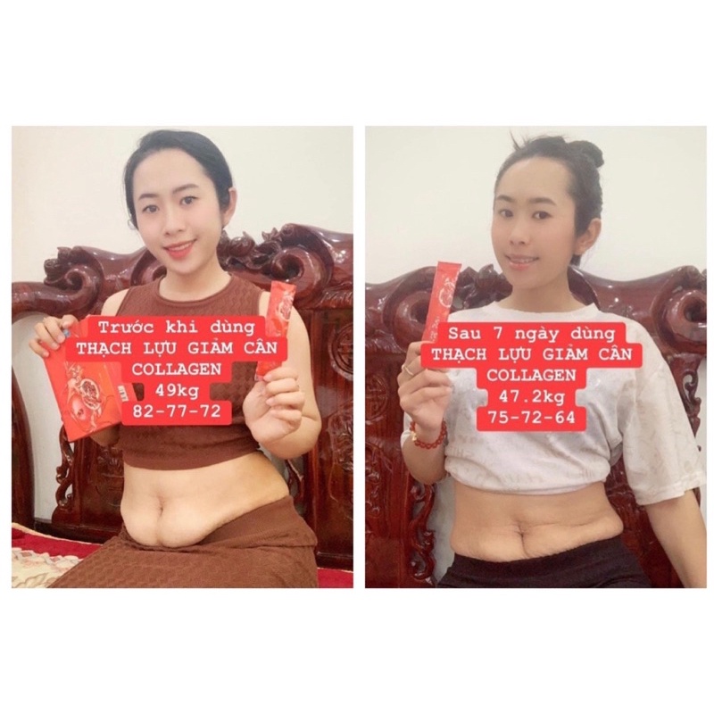 Thạch lựu giảm cân Matxicorp Chính hãng