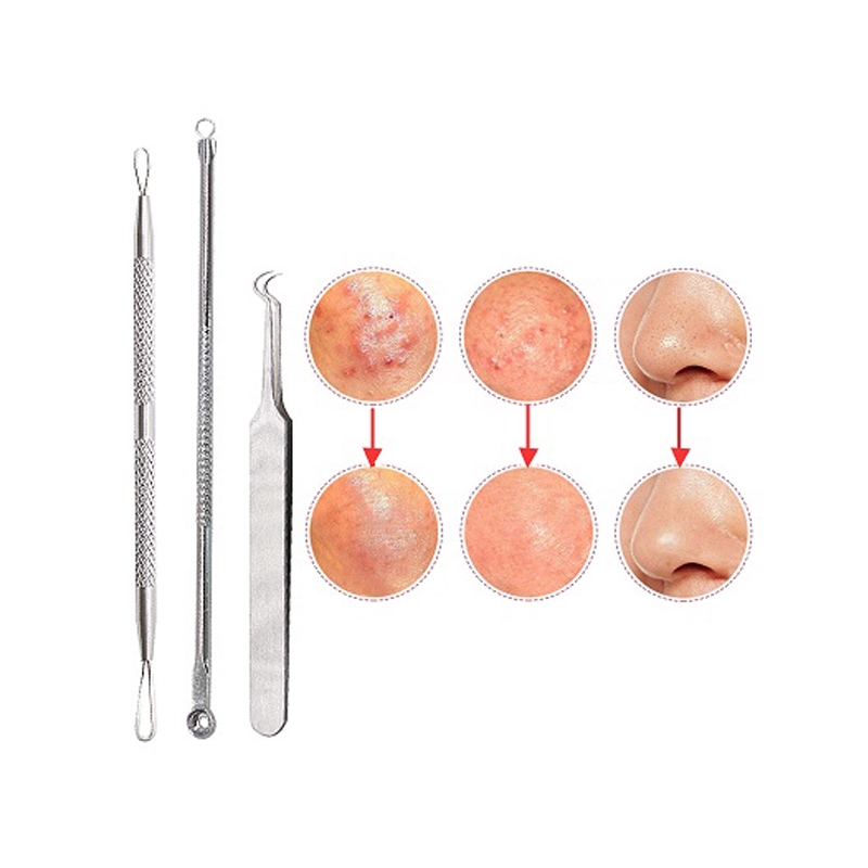 Dụng Cụ Nặn Mụn Đầu Đen Bằng Thép Không Gỉ