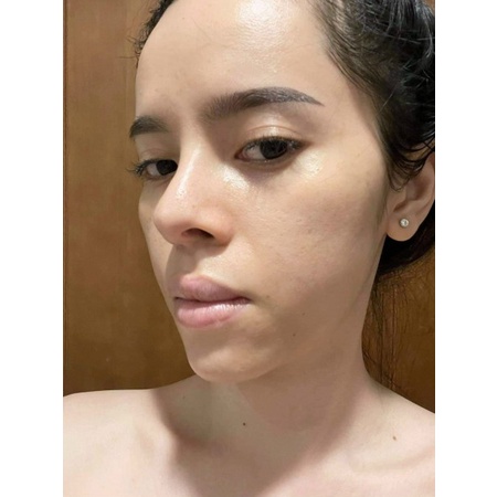 Kem nám cao cấp Happy - Melasma Treatment Cream Happy | BigBuy360 - bigbuy360.vn