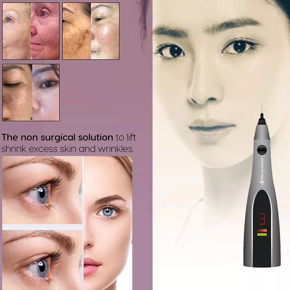 Máy Plasma Genius chuyên nâng cơ, xóa nhăn cho spa chuyên nghiệp