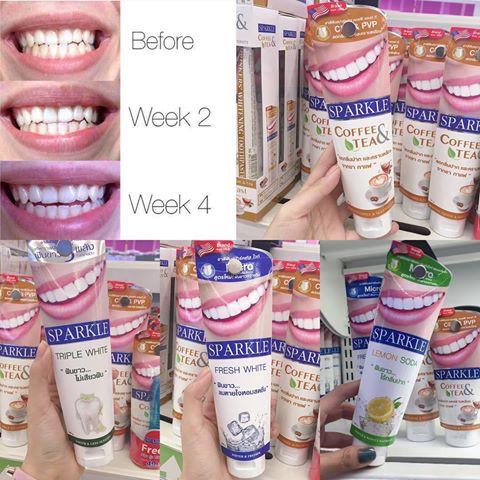 KEM ĐÁNH RĂNG SIÊU TRẮNG SPARKLE THÁI LAN 100G