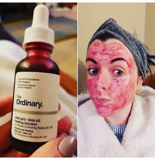 Peel da căng bóng The Ordinary AHA 30% + BHA 2% Peeling Solution