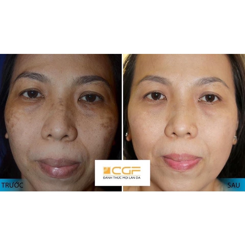 Kem Nám Đêm CGF Hàn Quốc