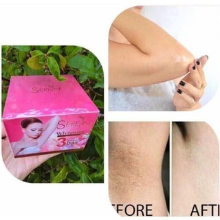 Kem giảm thâm nách Seren 3 day thái lan