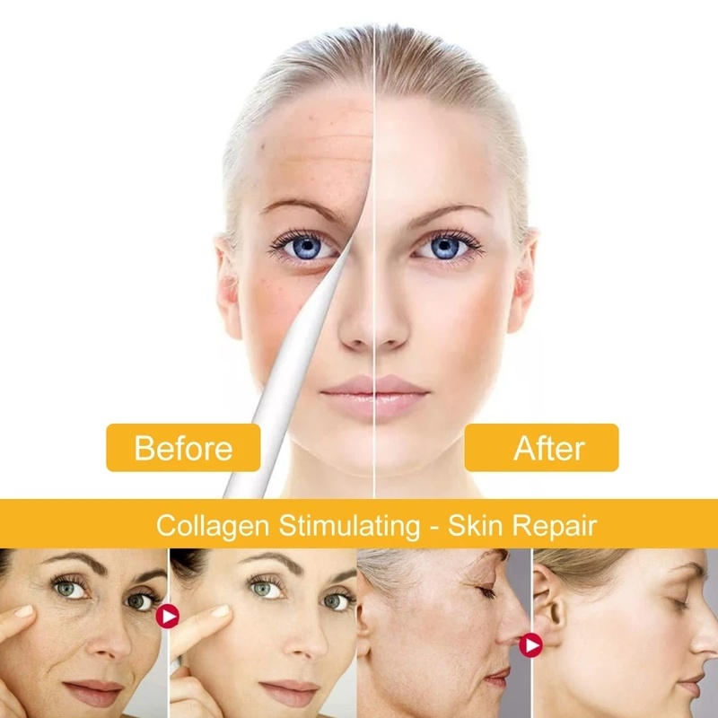 Serum Peptide Chống Lão Hóa/Nếp Nhăn Làm Săn Chắc Da/Làm Mờ Nếp Nhăn Dưỡng Ẩm Và Làm Trắng Da